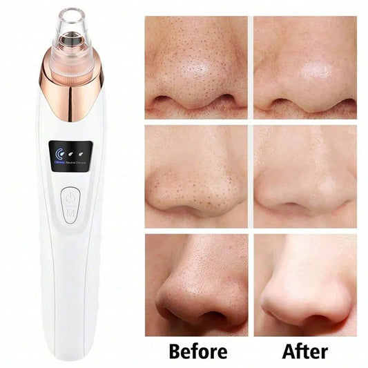 Revitalize Your Skin with the 2026 Facial Pore Cleaner - Powerful 5 Suction Levels for Effortless Blackhead Removal