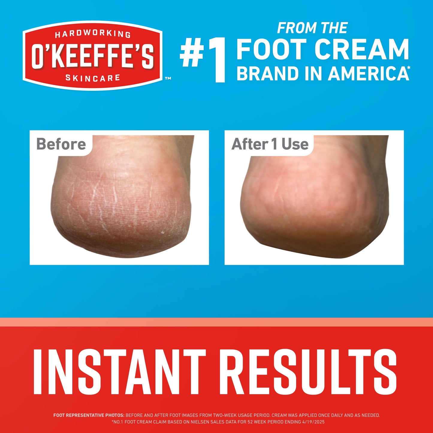 Healthy Feet Pain Relieving Foot Cream with Lidocaine, 3Oz Tube